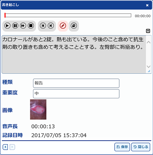 AmiVoice iVoX MedicalのPCで確認できる個別ポップアップ